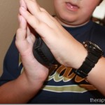 Recovering range of motion and strength after a broken arm